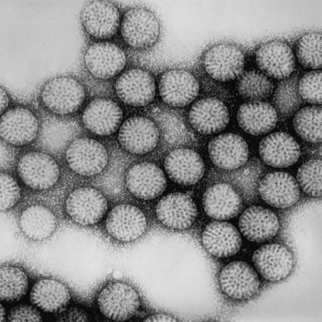 Rotavirus | foto:  phil.cdc.gov